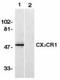 C-X3-C Motif Chemokine Receptor 1 antibody, TA336823, Origene, Western Blot image 