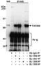 TATA-binding protein-associated factor 2N antibody, A300-307A, Bethyl Labs, Immunoprecipitation image 