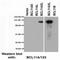 BAF Chromatin Remodeling Complex Subunit BCL11A antibody, NBP2-50115, Novus Biologicals, Western Blot image 