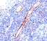 Platelet And Endothelial Cell Adhesion Molecule 1 antibody, V2220IHC-7ML, NSJ Bioreagents, Immunohistochemistry frozen image 