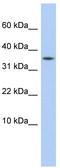 Protein Phosphatase 1 Regulatory Subunit 27 antibody, TA339948, Origene, Western Blot image 