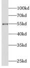 Lipase H antibody, FNab04795, FineTest, Western Blot image 