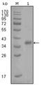 Fatty Acid Binding Protein 4 antibody, AM06259SU-N, Origene, Western Blot image 