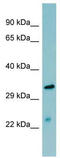 Mannan Binding Lectin Serine Peptidase 2 antibody, TA346116, Origene, Western Blot image 
