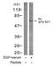 SRC Proto-Oncogene, Non-Receptor Tyrosine Kinase antibody, GTX78941, GeneTex, Western Blot image 