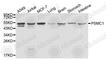 Proteasome 26S Subunit, ATPase 1 antibody, A1040, ABclonal Technology, Western Blot image 