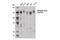 Unc-51 Like Autophagy Activating Kinase 1 antibody, 14202S, Cell Signaling Technology, Western Blot image 