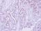 Cell Adhesion Associated, Oncogene Regulated antibody, NBP2-15849, Novus Biologicals, Immunohistochemistry paraffin image 