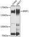 BRCA1 Interacting Protein C-Terminal Helicase 1 antibody, A6804, ABclonal Technology, Western Blot image 