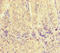 Voltage-dependent anion-selective channel protein 2 antibody, LS-C679976, Lifespan Biosciences, Immunohistochemistry paraffin image 