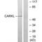 Sedoheptulokinase antibody, PA5-49892, Invitrogen Antibodies, Western Blot image 