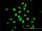 YY1 Transcription Factor antibody, H00007528-M03, Novus Biologicals, Immunocytochemistry image 