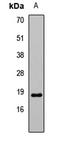 Mitochondrial import inner membrane translocase subunit Tim17-B antibody, LS-C668327, Lifespan Biosciences, Western Blot image 