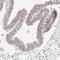 Ribosomal Protein S21 antibody, NBP1-87100, Novus Biologicals, Immunohistochemistry paraffin image 