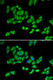 2-oxoglutarate dehydrogenase, mitochondrial antibody, 14-447, ProSci, Immunofluorescence image 