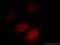 AKAP7 antibody, 12591-1-AP, Proteintech Group, Immunofluorescence image 