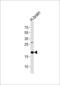 Eukaryotic Translation Initiation Factor 4E Binding Protein 2 antibody, 60-797, ProSci, Western Blot image 