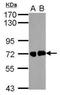Helicobacter pylori urease B antibody, NBP2-42850, Novus Biologicals, Western Blot image 