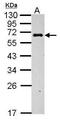 Complement Component 4 Binding Protein Beta antibody, PA5-28017, Invitrogen Antibodies, Western Blot image 