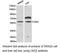CES2 antibody, LS-C192998, Lifespan Biosciences, Western Blot image 