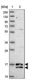 Chromosome 19 Open Reading Frame 25 antibody, PA5-62161, Invitrogen Antibodies, Western Blot image 