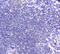 B And T Lymphocyte Associated antibody, A03149, Boster Biological Technology, Immunohistochemistry frozen image 