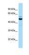 Enhancer Of MRNA Decapping 3 antibody, orb331300, Biorbyt, Western Blot image 