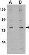 Dihydropyrimidinase-related protein 1 antibody, GTX31369, GeneTex, Western Blot image 