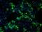 Heat Shock Protein Family A (Hsp70) Member 9 antibody, GTX84332, GeneTex, Immunocytochemistry image 