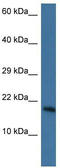 PNKD Metallo-Beta-Lactamase Domain Containing antibody, TA335592, Origene, Western Blot image 