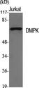 DM1 Protein Kinase antibody, A00797, Boster Biological Technology, Western Blot image 