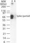 SARS Spike glycoprotein antibody, NB100-56047, Novus Biologicals, Western Blot image 