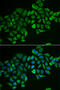Rho-related GTP-binding protein RhoD antibody, 22-243, ProSci, Immunofluorescence image 