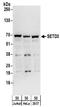 SET Domain Containing 3, Actin Histidine Methyltransferase antibody, NBP2-32137, Novus Biologicals, Western Blot image 