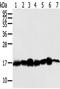 Nucleoside diphosphate kinase B antibody, TA351806, Origene, Western Blot image 