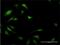 Eukaryotic Translation Initiation Factor 5A antibody, H00001984-M01, Novus Biologicals, Immunocytochemistry image 