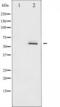 PKB beta antibody, TA325223, Origene, Western Blot image 