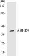 Epoxide Hydrolase 3 antibody, EKC1011, Boster Biological Technology, Western Blot image 