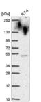 Cysteine antibody, NBP2-56486, Novus Biologicals, Western Blot image 