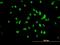Autoantigen NOR-90 antibody, H00007343-M03, Novus Biologicals, Immunocytochemistry image 