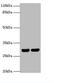 HLA class II histocompatibility antigen, DRB1-12 beta chain antibody, abx306617, Abbexa, Western Blot image 