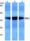 Mitochondrially Encoded NADH:Ubiquinone Oxidoreductase Core Subunit 1 antibody, GTX66712, GeneTex, Western Blot image 
