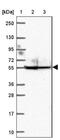 Ankyrin Repeat Domain 65 antibody, NBP2-39062, Novus Biologicals, Western Blot image 