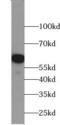 1,25-dihydroxyvitamin D(3) 24-hydroxylase, mitochondrial antibody, FNab02151, FineTest, Western Blot image 