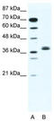 Class E basic helix-loop-helix protein 22 antibody, TA330535, Origene, Western Blot image 