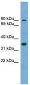 NSE3 Homolog, SMC5-SMC6 Complex Component antibody, TA344633, Origene, Western Blot image 