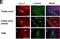 CLL-1 antibody, H00010584-M01, Novus Biologicals, Immunohistochemistry paraffin image 