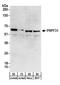 Pre-MRNA Processing Factor 31 antibody, A303-919A, Bethyl Labs, Western Blot image 
