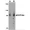 Centrosomal Protein 164 antibody, MBS151198, MyBioSource, Western Blot image 