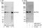 Serine/threonine-protein kinase N2 antibody, A302-443A, Bethyl Labs, Immunoprecipitation image 